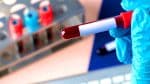 Attention anémiques : ce thé quotidien pourrait saboter votre énergie vitale en bloquant l&rsquo;absorption de fer clé