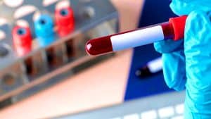 Anémie : pourquoi boire du thé pourrait aggraver votre état et freiner votre guérison Attention anémiques : ce thé quotidien pourrait saboter votre énergie vitale en bloquant l’absorption de fer clé