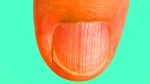 Ces lignes sur vos ongles : un indicateur de santé aussi alarmant qu&rsquo;un thermomètre à 40°C ? Découvrez les secrets cachés de vos mains